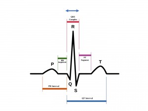 心電図異常を指摘されたら その３ | あわのこどもクリニック